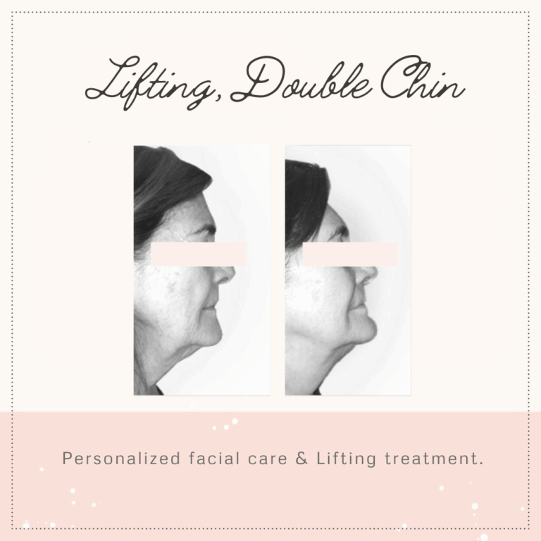 lifting_before-and-after-1-1