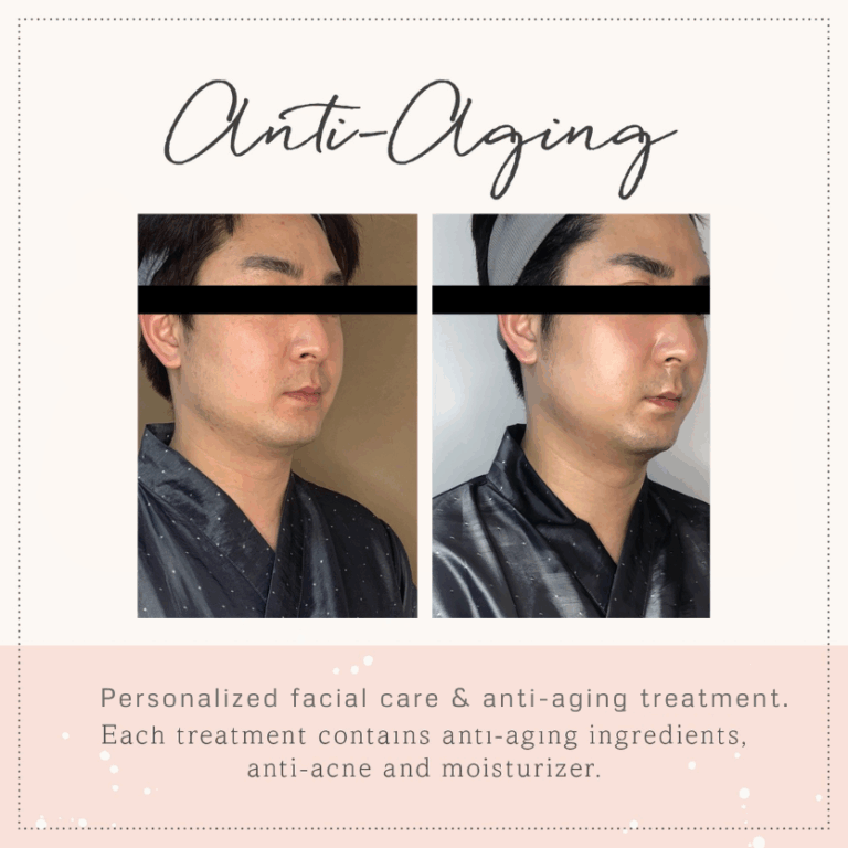 before-and-after-_antiaging-1.png