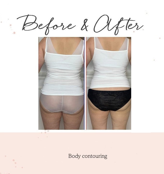 body-contouring1-2.jpg
